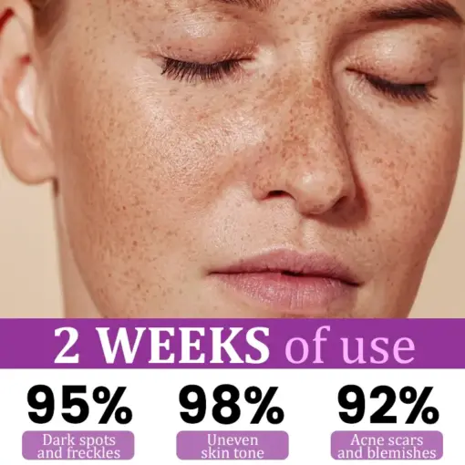 Glowrizon™ MelantraX Advanced Anti-Hyperpigmentation Essence