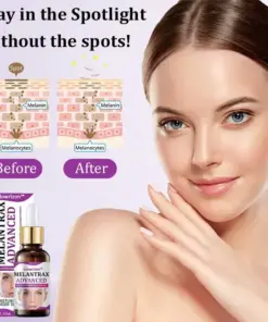 Glowrizon™ MelantraX Advanced Anti-Hyperpigmentation Essence