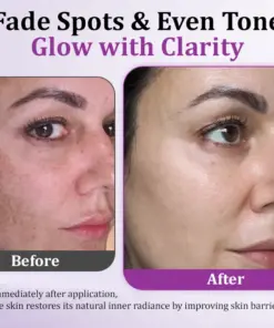 Glowrizon™ MelantraX Advanced Anti-Hyperpigmentation Essence