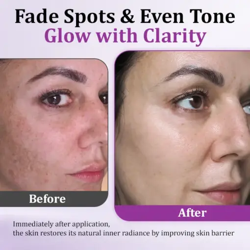 Glowrizon™ MelantraX Advanced Anti-Hyperpigmentation Essence