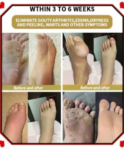 Glowrizon™ Wasp Venom Foot Detox
