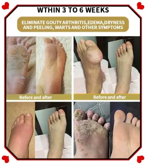 Glowrizon™ Wasp Venom Foot Detox