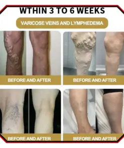 Glowrizon™ Wasp Venom Foot Detox