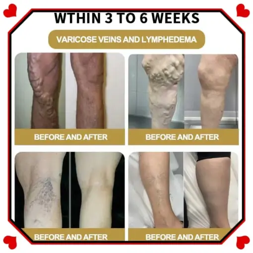 Glowrizon™ Wasp Venom Foot Detox