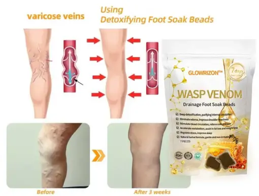 Glowrizon™ Wasp Venom Foot Detox
