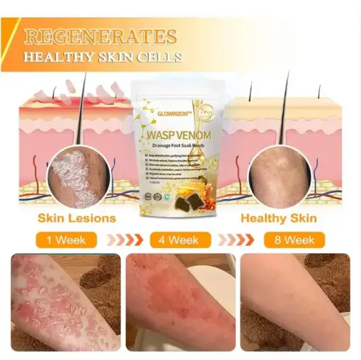 Glowrizon™ Wasp Venom Foot Detox